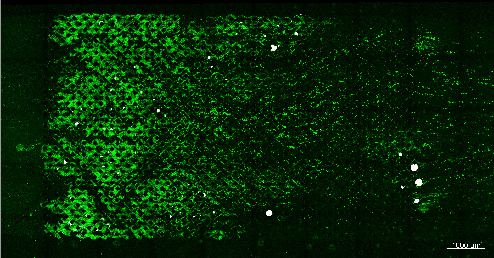 Biofilm